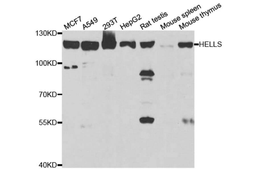 Western blot - HELLS Antibody from Signalway Antibody (33073) - Antibodies.com