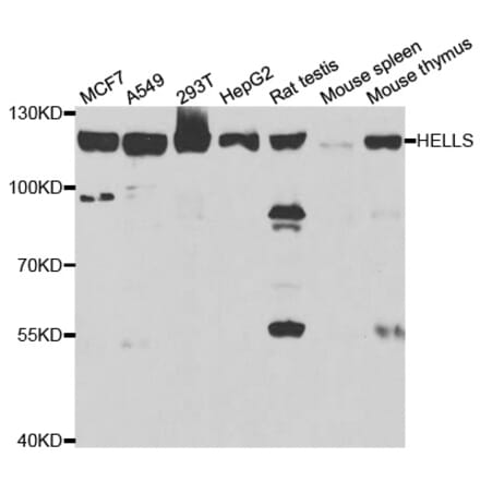 Western blot - HELLS Antibody from Signalway Antibody (33073) - Antibodies.com