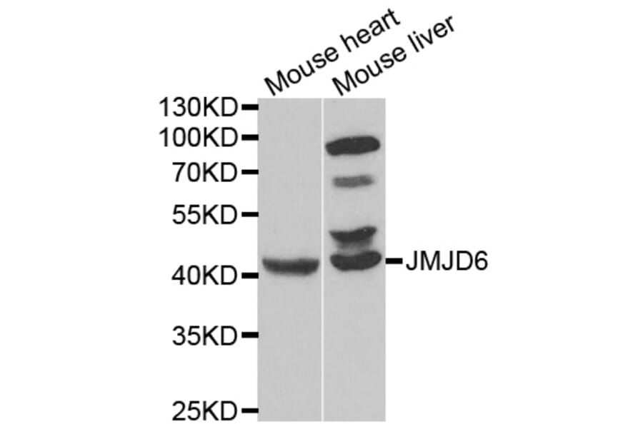 Western blot - JMJD6 Antibody from Signalway Antibody (33079) - Antibodies.com