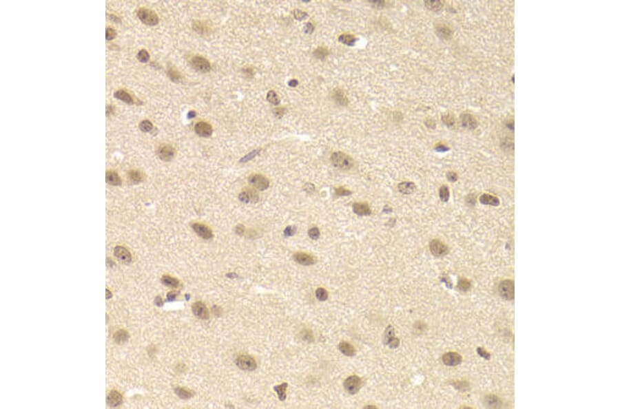 Immunohistochemistry - JMJD6 Antibody from Signalway Antibody (33079) - Antibodies.com