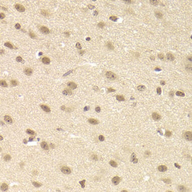 Immunohistochemistry - JMJD6 Antibody from Signalway Antibody (33079) - Antibodies.com