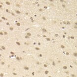 Immunohistochemistry - JMJD6 Antibody from Signalway Antibody (33079) - Antibodies.com