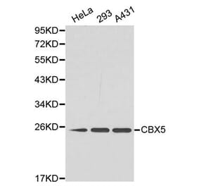 Western blot - CBX5 Antibody from Signalway Antibody (32158) - Antibodies.com