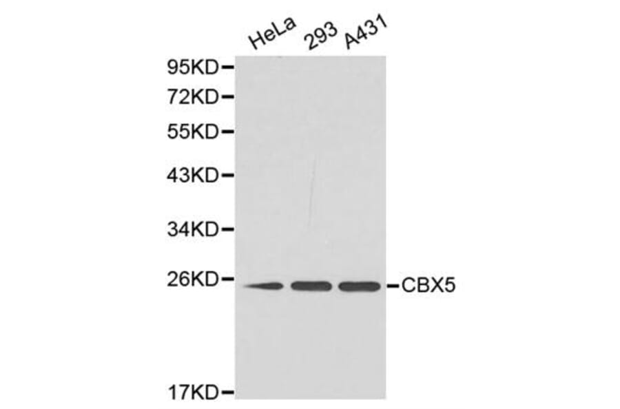 Western blot - CBX5 Antibody from Signalway Antibody (32158) - Antibodies.com