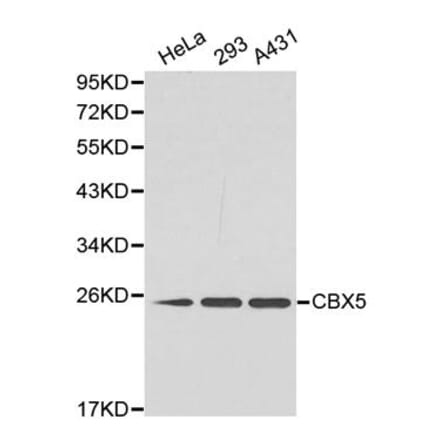 Western blot - CBX5 Antibody from Signalway Antibody (32158) - Antibodies.com