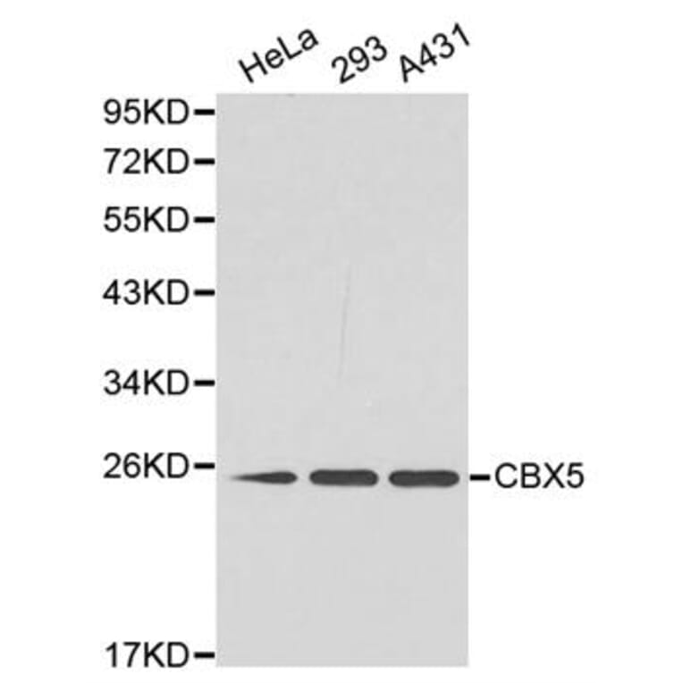 Western blot - CBX5 Antibody from Signalway Antibody (32158) - Antibodies.com