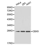 Western blot - CBX5 Antibody from Signalway Antibody (32158) - Antibodies.com