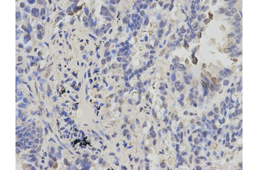 Immunohistochemistry - CBX5 Antibody from Signalway Antibody (32158) - Antibodies.com