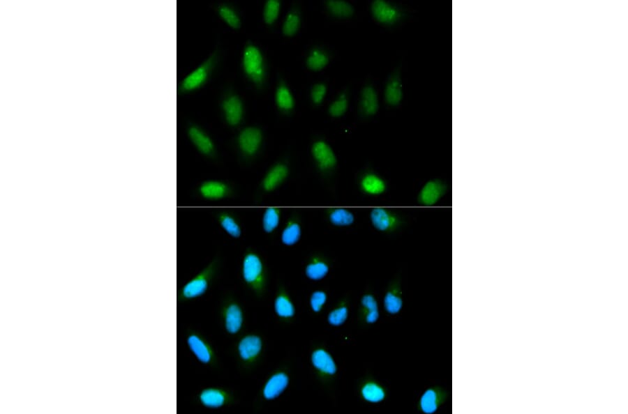 Immunofluorescence - CBX5 Antibody from Signalway Antibody (32158) - Antibodies.com