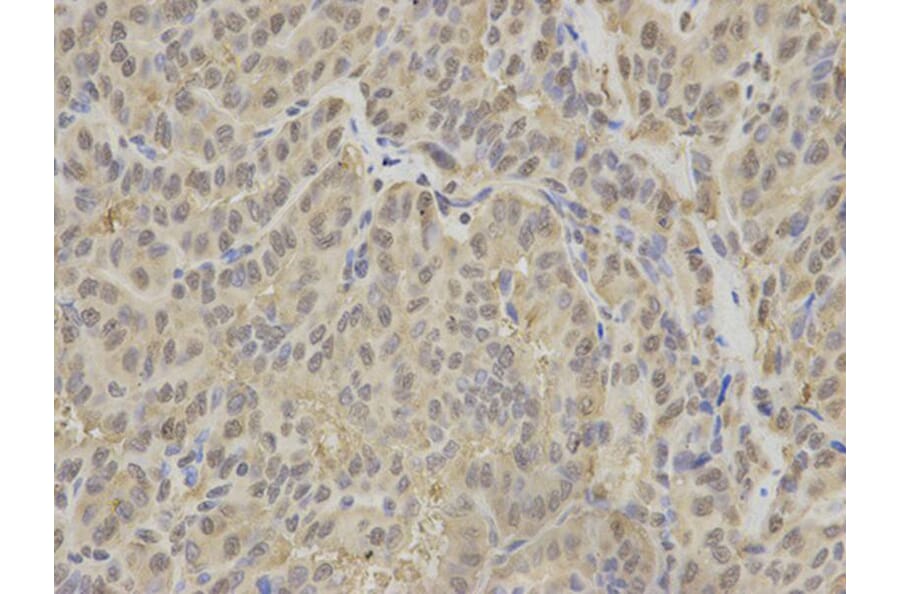 Immunohistochemistry - IDH1 Antibody from Signalway Antibody (32637) - Antibodies.com