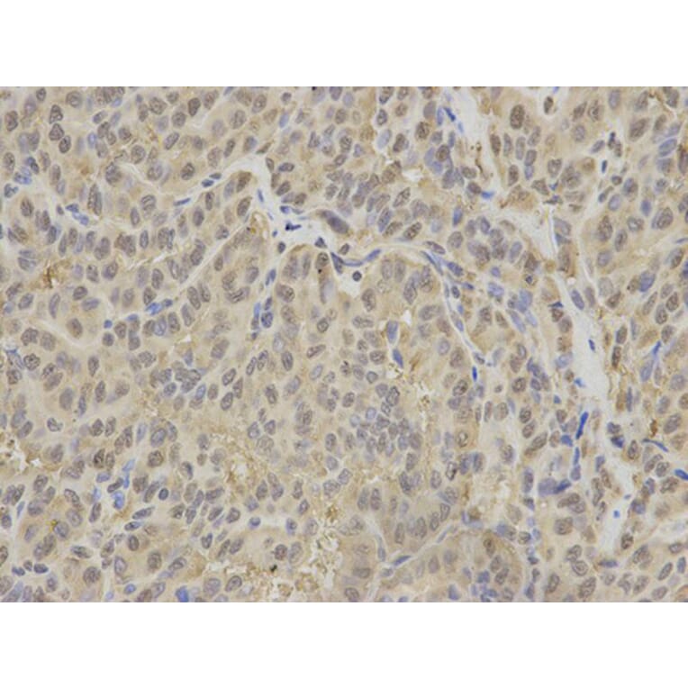 Immunohistochemistry - IDH1 Antibody from Signalway Antibody (32637) - Antibodies.com