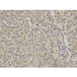 Immunohistochemistry - IDH1 Antibody from Signalway Antibody (32637) - Antibodies.com