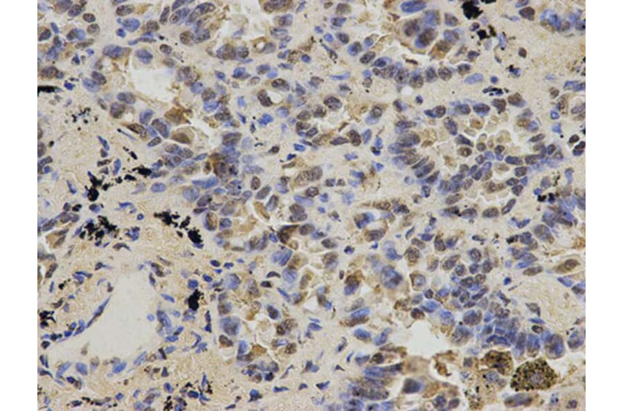 Immunohistochemistry - IDH1 Antibody from Signalway Antibody (32637) - Antibodies.com