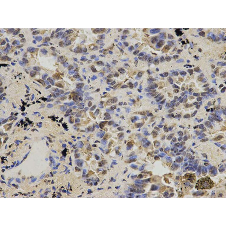 Immunohistochemistry - IDH1 Antibody from Signalway Antibody (32637) - Antibodies.com