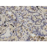 Immunohistochemistry - IDH1 Antibody from Signalway Antibody (32637) - Antibodies.com