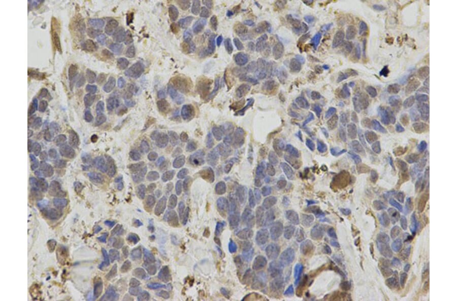 Immunohistochemistry - IDH1 Antibody from Signalway Antibody (32637) - Antibodies.com