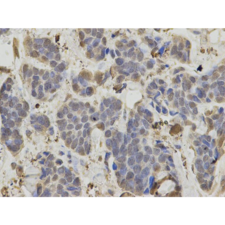 Immunohistochemistry - IDH1 Antibody from Signalway Antibody (32637) - Antibodies.com