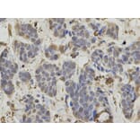 Immunohistochemistry - IDH1 Antibody from Signalway Antibody (32637) - Antibodies.com