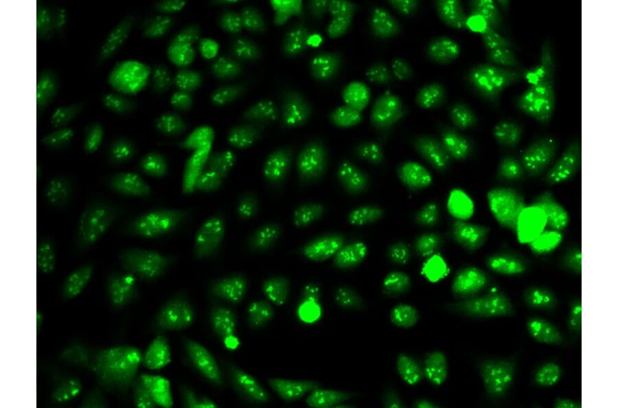 Immunofluorescence - IDH1 Antibody from Signalway Antibody (32637) - Antibodies.com