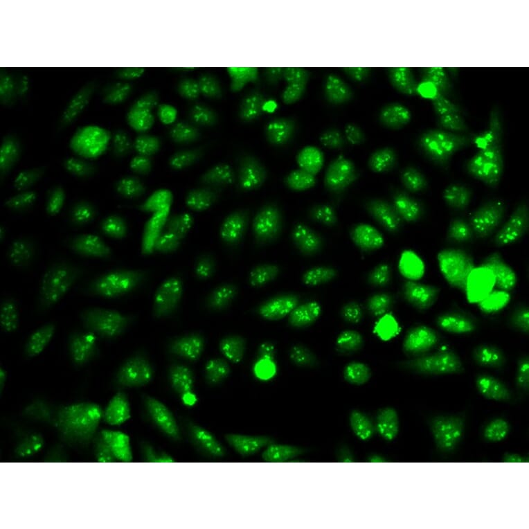 Immunofluorescence - IDH1 Antibody from Signalway Antibody (32637) - Antibodies.com