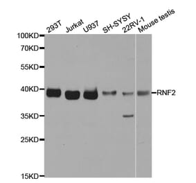 Western blot - RNF2 Antibody from Signalway Antibody (32914) - Antibodies.com