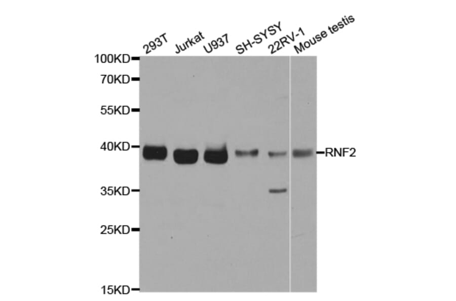 Western blot - RNF2 Antibody from Signalway Antibody (32914) - Antibodies.com
