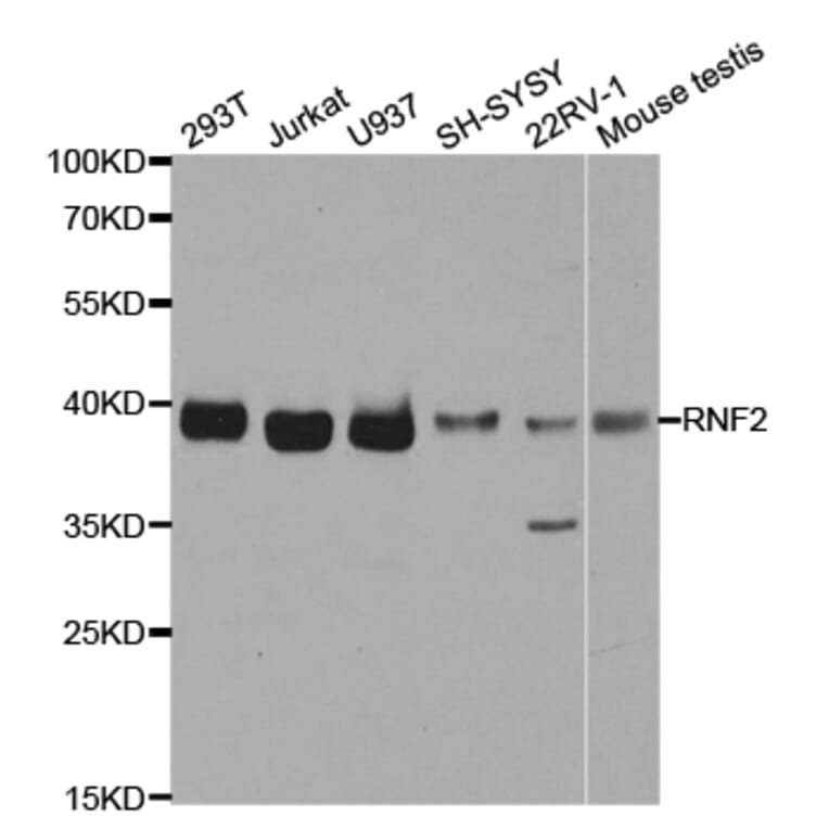 Western blot - RNF2 Antibody from Signalway Antibody (32914) - Antibodies.com