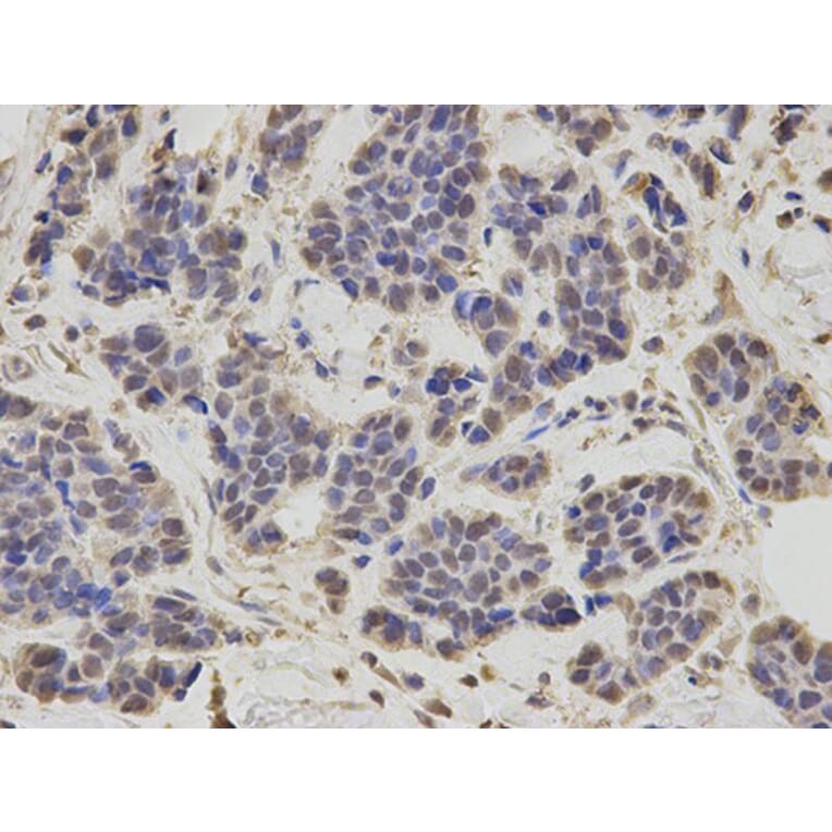 Immunohistochemistry - RNF2 Antibody from Signalway Antibody (32914) - Antibodies.com