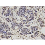 Immunohistochemistry - RNF2 Antibody from Signalway Antibody (32914) - Antibodies.com
