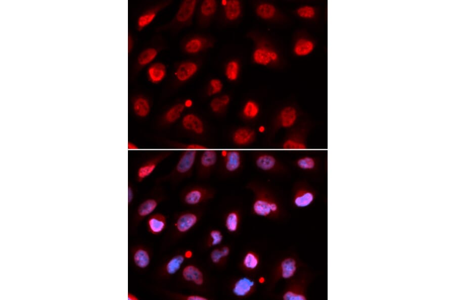 Immunofluorescence - RNF2 Antibody from Signalway Antibody (32914) - Antibodies.com