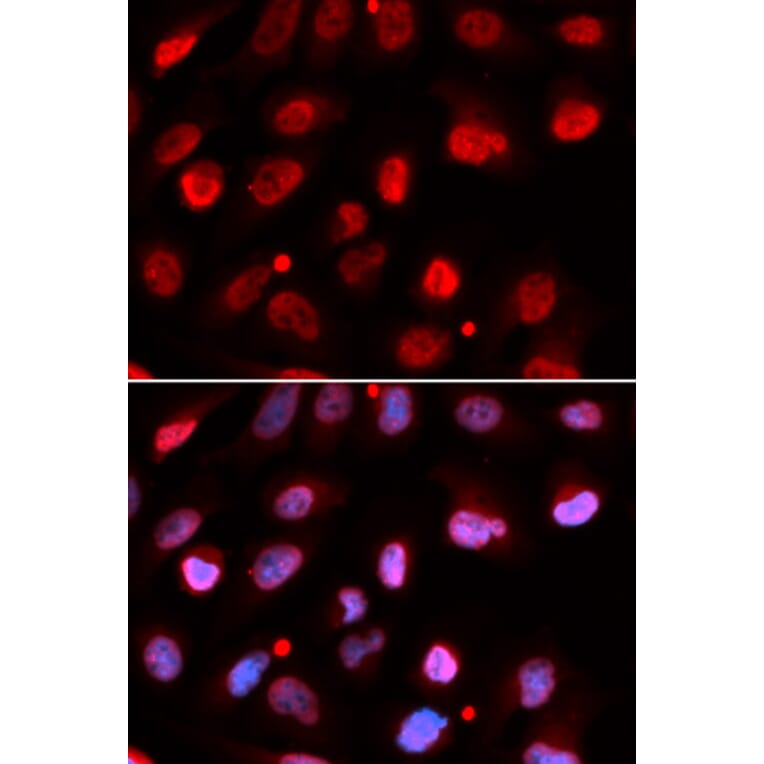 Immunofluorescence - RNF2 Antibody from Signalway Antibody (32914) - Antibodies.com