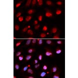 Immunofluorescence - RNF2 Antibody from Signalway Antibody (32914) - Antibodies.com
