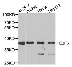 Western blot - E2F6 Antibody from Signalway Antibody (33109) - Antibodies.com