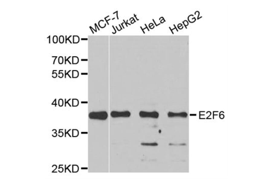 Western blot - E2F6 Antibody from Signalway Antibody (33109) - Antibodies.com