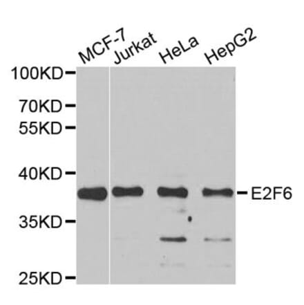 Western blot - E2F6 Antibody from Signalway Antibody (33109) - Antibodies.com