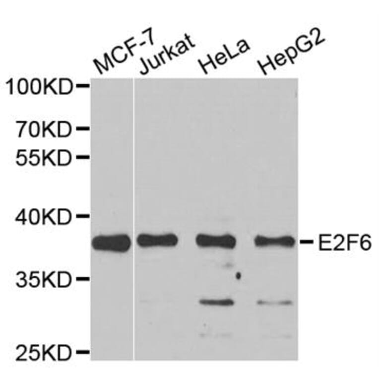 Western blot - E2F6 Antibody from Signalway Antibody (33109) - Antibodies.com