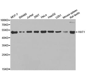 Western blot - HAT1 Antibody from Signalway Antibody (33111) - Antibodies.com