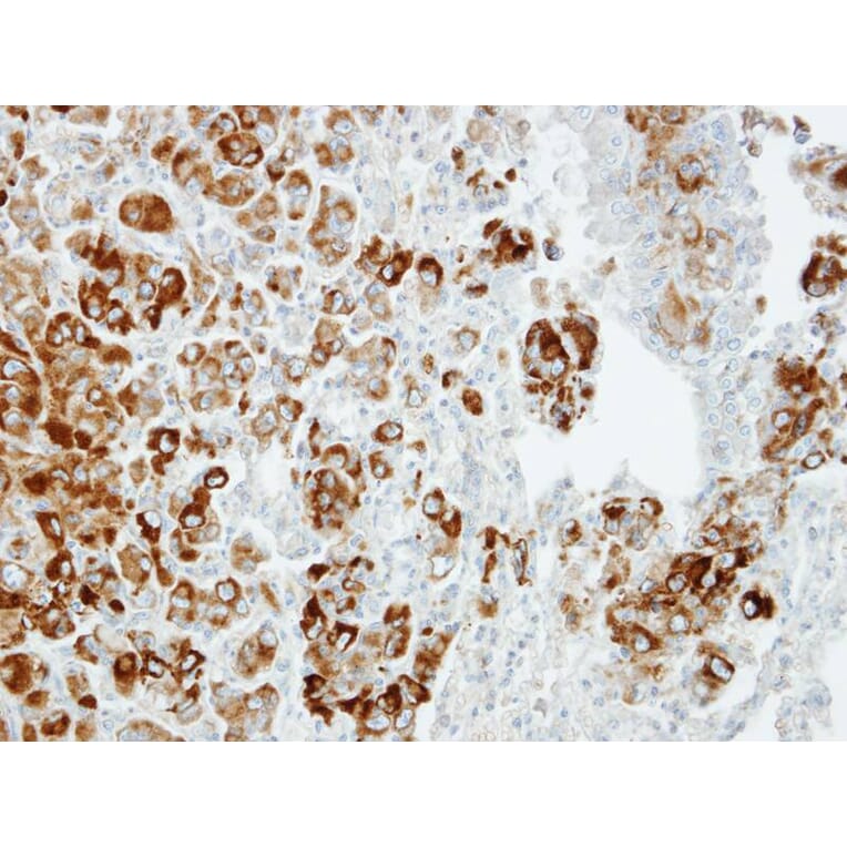 Immunohistochemistry - Importin 13 antibody from Signalway Antibody (22054) - Antibodies.com