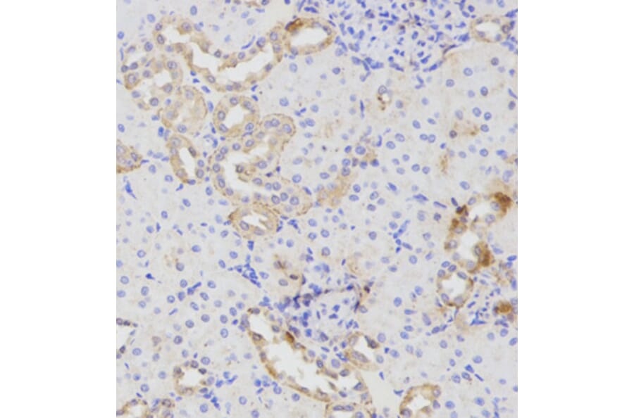 Immunohistochemistry - ATG16L1 Antibody from Signalway Antibody (32481) - Antibodies.com