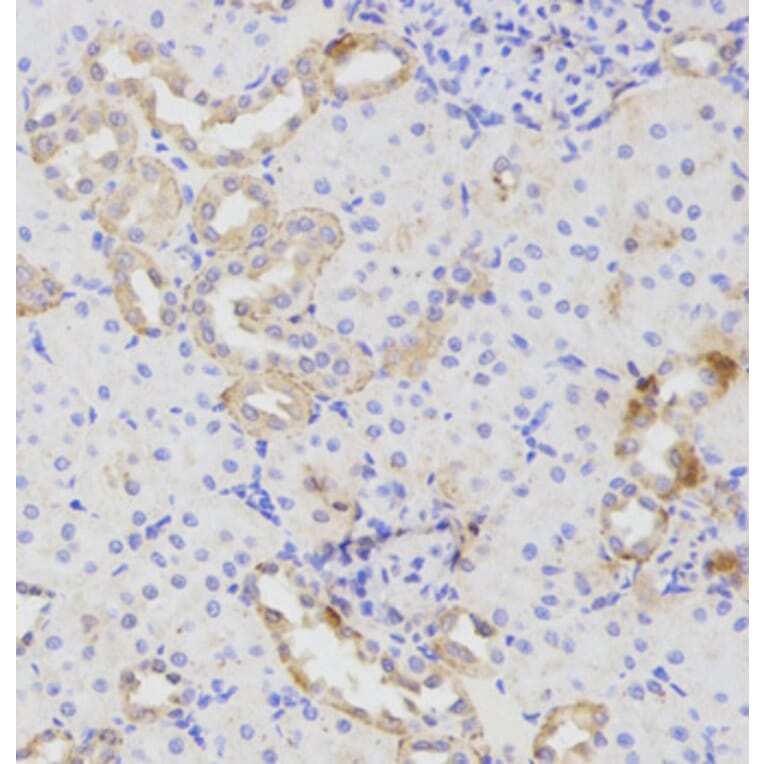 Immunohistochemistry - ATG16L1 Antibody from Signalway Antibody (32481) - Antibodies.com