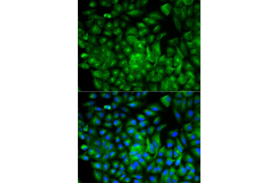 Immunofluorescence - ATG16L1 Antibody from Signalway Antibody (32481) - Antibodies.com