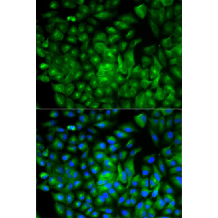 Immunofluorescence - ATG16L1 Antibody from Signalway Antibody (32481) - Antibodies.com