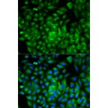 Immunofluorescence - ATG16L1 Antibody from Signalway Antibody (32481) - Antibodies.com