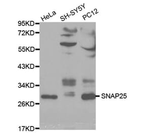 Western blot - SNAP25 Antibody from Signalway Antibody (32111) - Antibodies.com