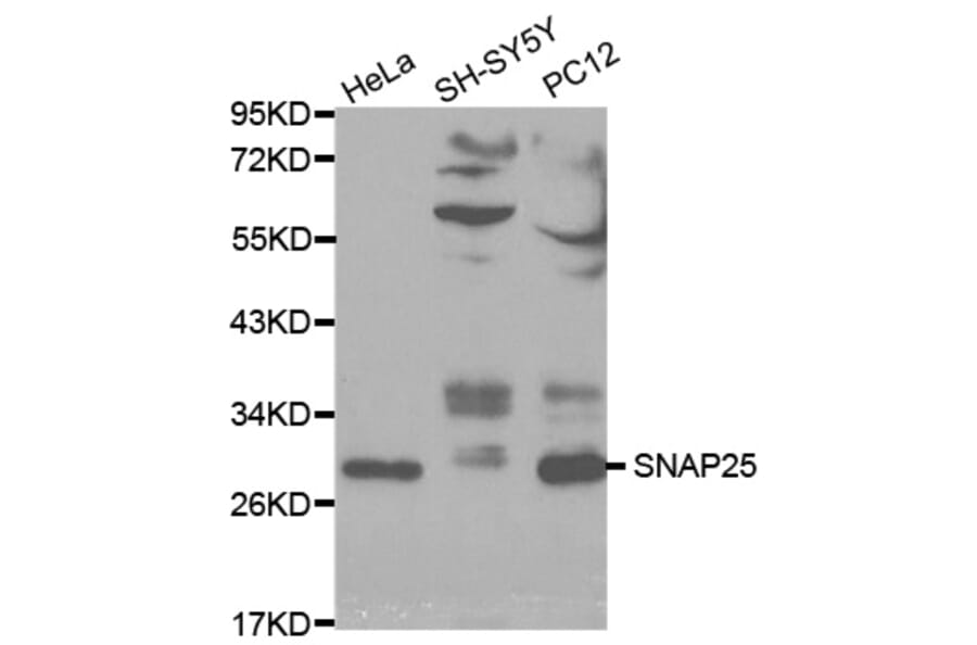 Western blot - SNAP25 Antibody from Signalway Antibody (32111) - Antibodies.com