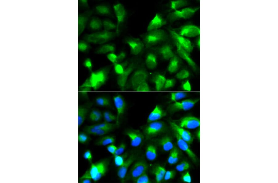 Immunofluorescence - SNAP25 Antibody from Signalway Antibody (32111) - Antibodies.com