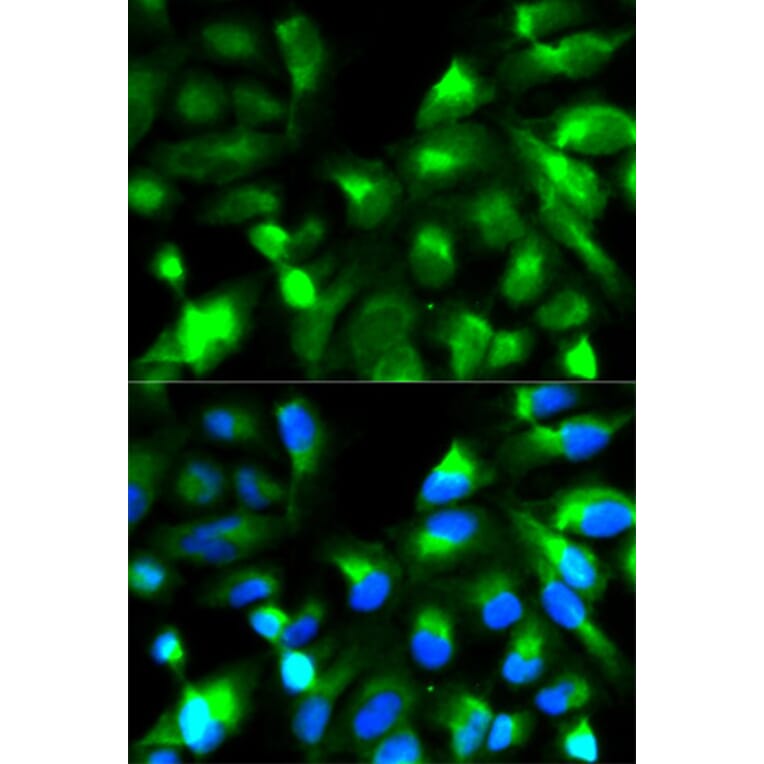 Immunofluorescence - SNAP25 Antibody from Signalway Antibody (32111) - Antibodies.com