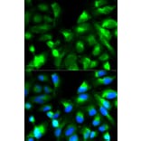 Immunofluorescence - SNAP25 Antibody from Signalway Antibody (32111) - Antibodies.com