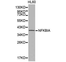 Western blot - NFKBIA Antibody from Signalway Antibody (32213) - Antibodies.com