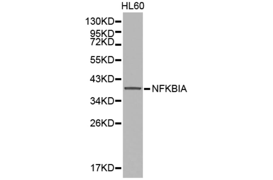 Western blot - NFKBIA Antibody from Signalway Antibody (32213) - Antibodies.com